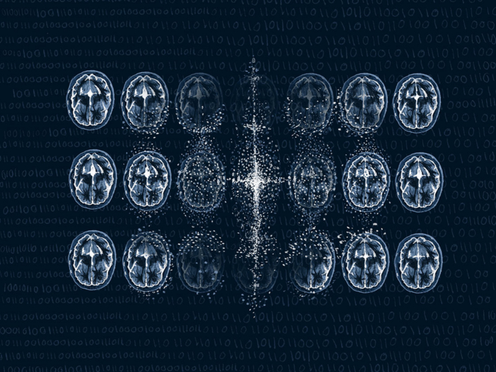 Graphic illustrating functional MRI brain scans being converted into synthetic scans.