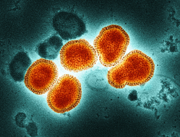 Photo of viruses